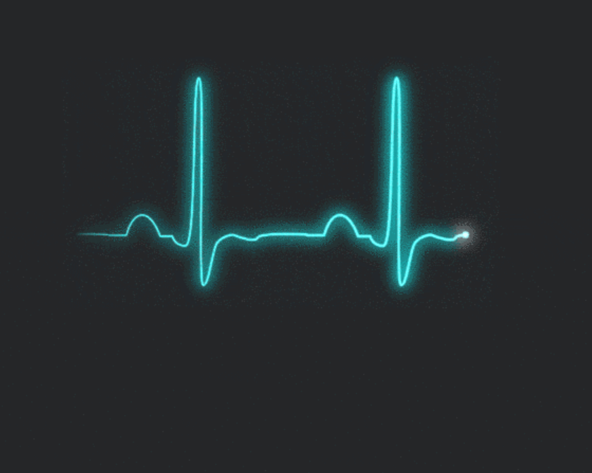 Heartbeat Anomaly Detection