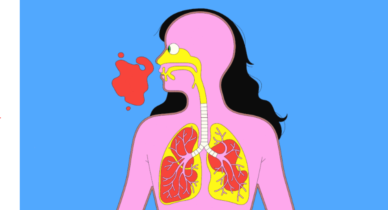 Using lung CT scans for Covid 19 diagnosis